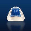 10pcs lingual retainer bonding splints na may marka